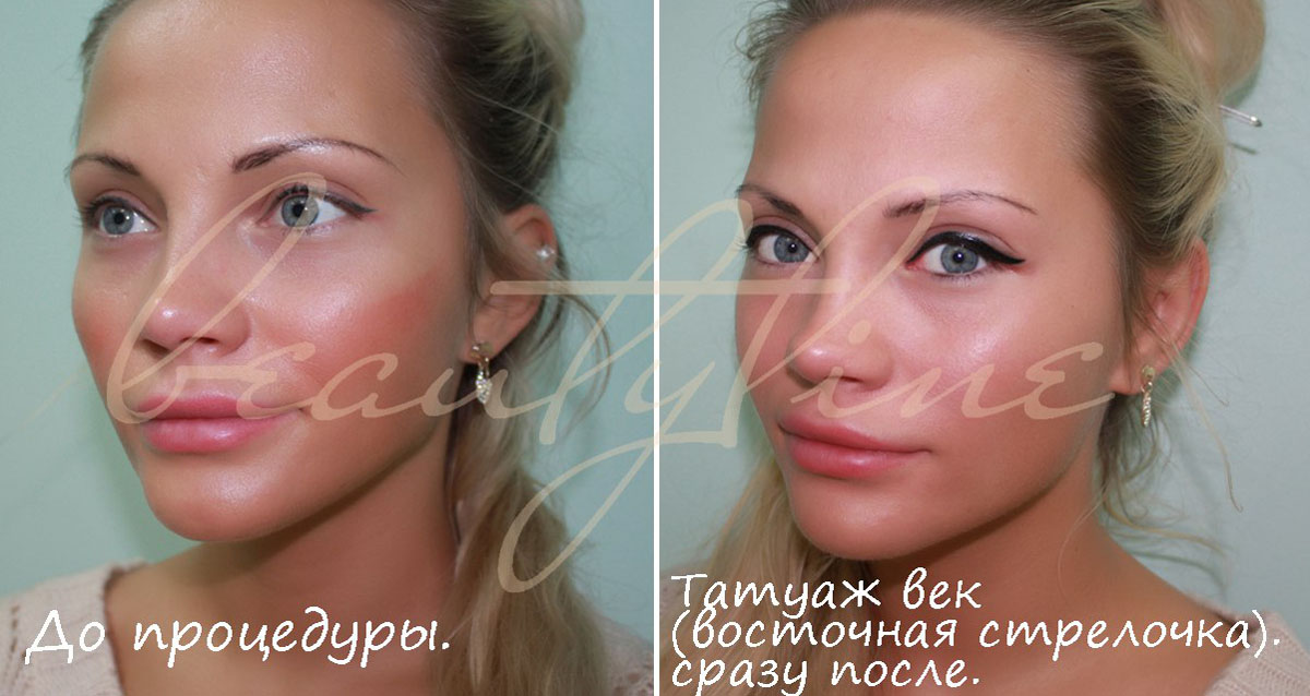 Опухла десна как лечить в домашних условиях Опухла десна как лечить в домашних условиях